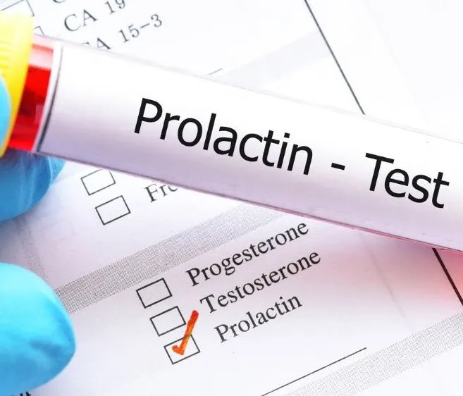 Prolactin Test