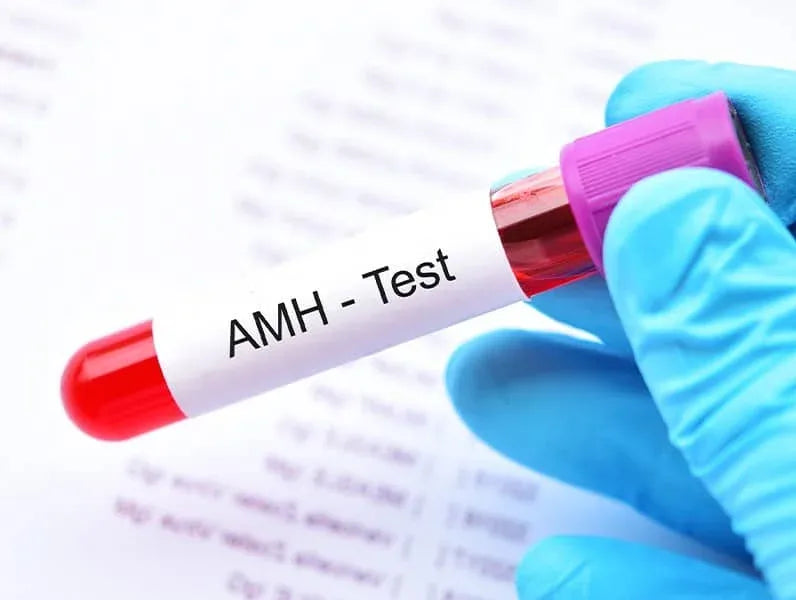 Anti-Müllerian Hormone (AMH)