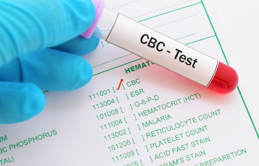 CBC (Complete Blood Count)
