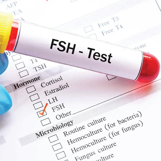 FSH Follicle-Stimulating Hormone Test