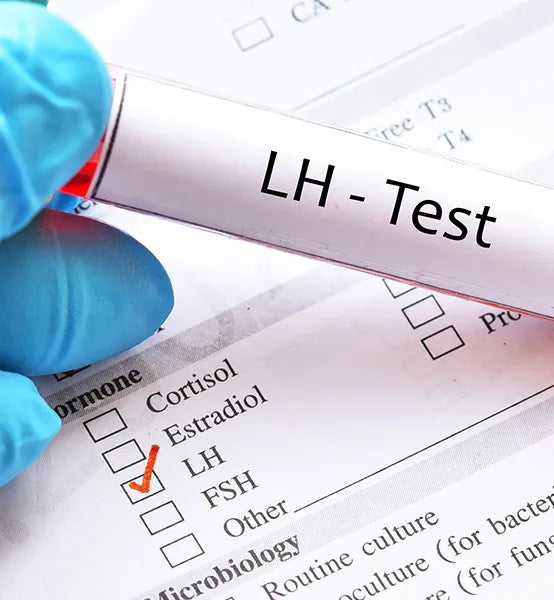 LH (Luteinizing Hormone) Test