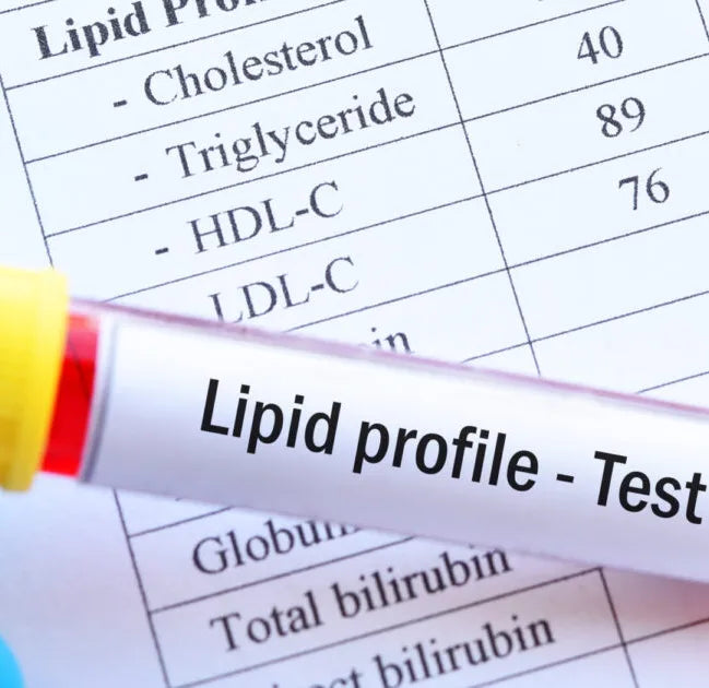 Lipid Panel (Cholesterol Test)