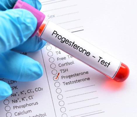 Progesterone Test