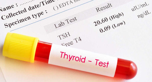 TRAb (Thyroid Receptor Antibodies)