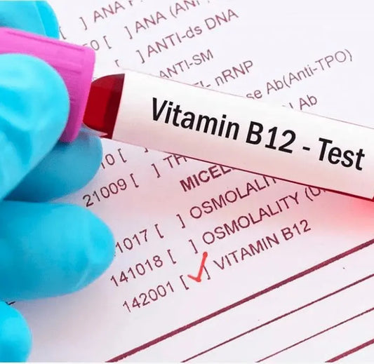 Vitamin B12 Test