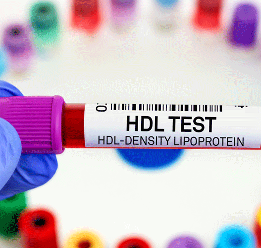 HDL (High-Density Lipoprotein)