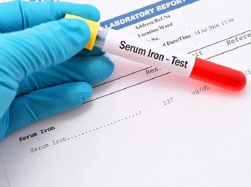 Iron Serum Test