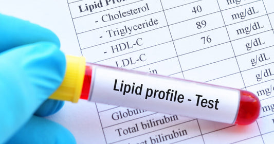 Lipid Panel