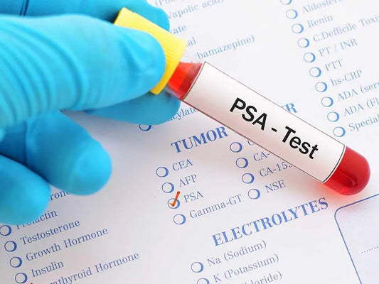 Prostate Specific Antigen