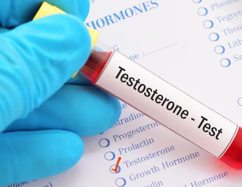 Testosterone Total