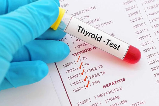 TPO (Thyroid Peroxidase Antibodies)