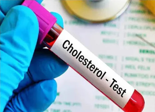 Total Cholesterol