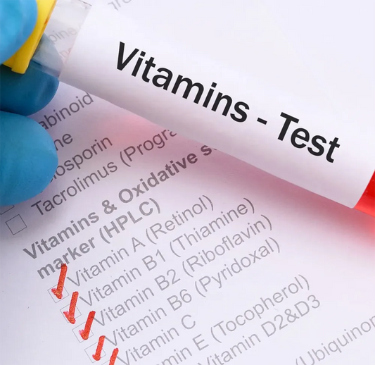 Vitamin A Test