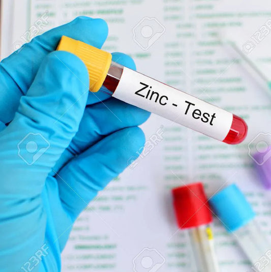 Zinc test